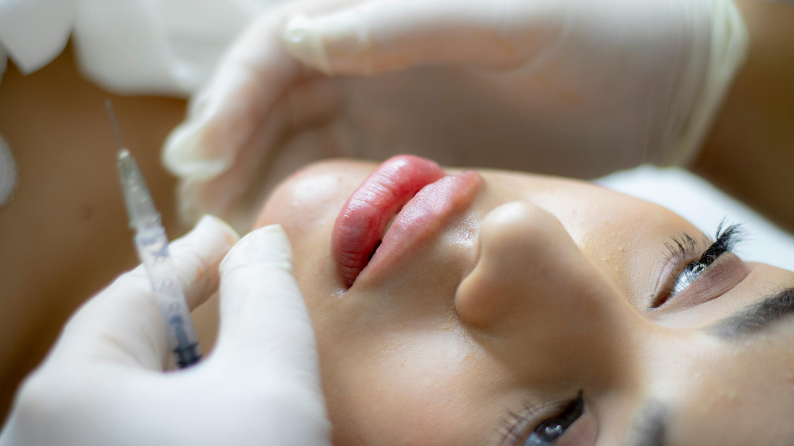 10 Aftercare Tips to Reduce Swelling After Lip Filler
