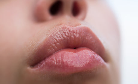 Lip Fillers - Your Questions Answered