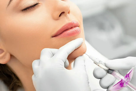 Profhilo Injection Points for Best Results