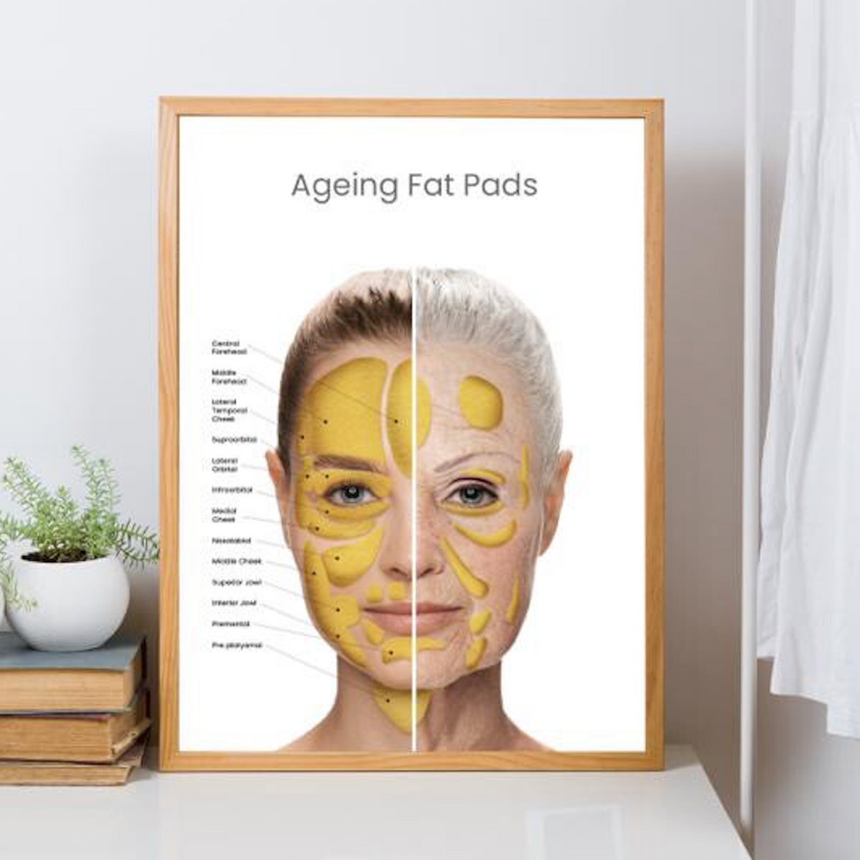 Aging Fat Pad Poster Laminated