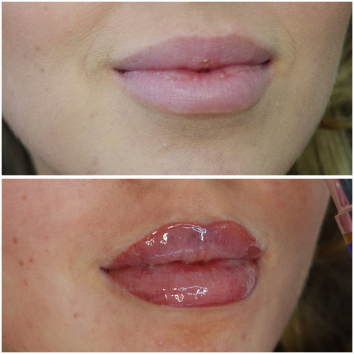 AfterMED LIPS
